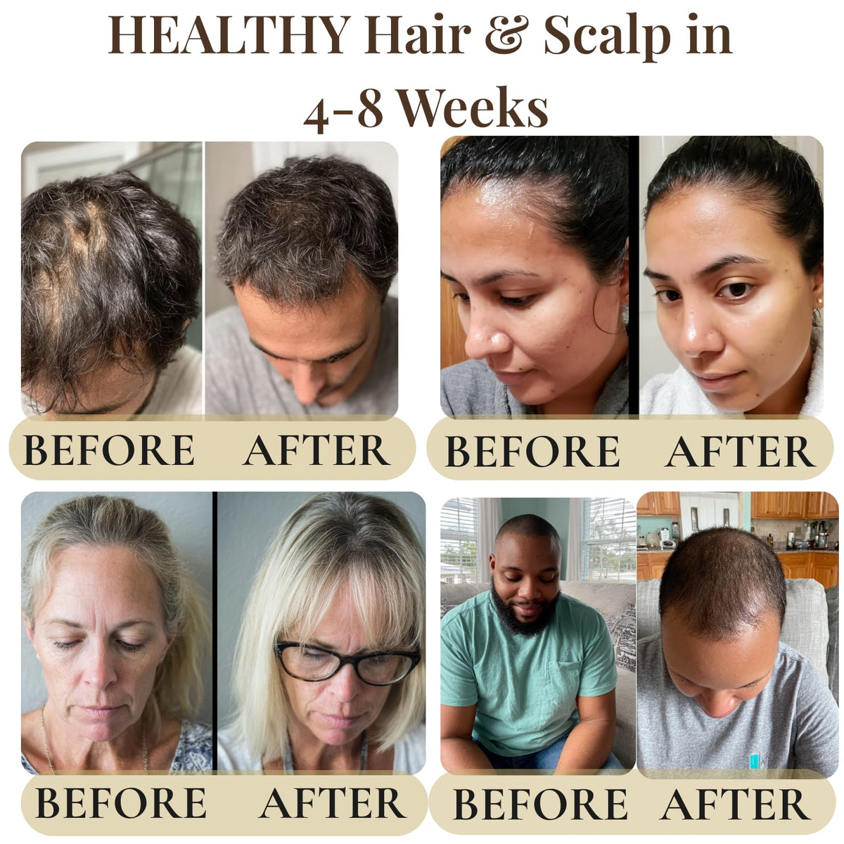 Revatology Hair Growth Oil for Adults, Ayurvedic Pre Wash and Overnight Scalp Treatment for Thinning Hair, 30 Cold Pressed Botanicals with Rosemary and Castor Oil, Made in USA